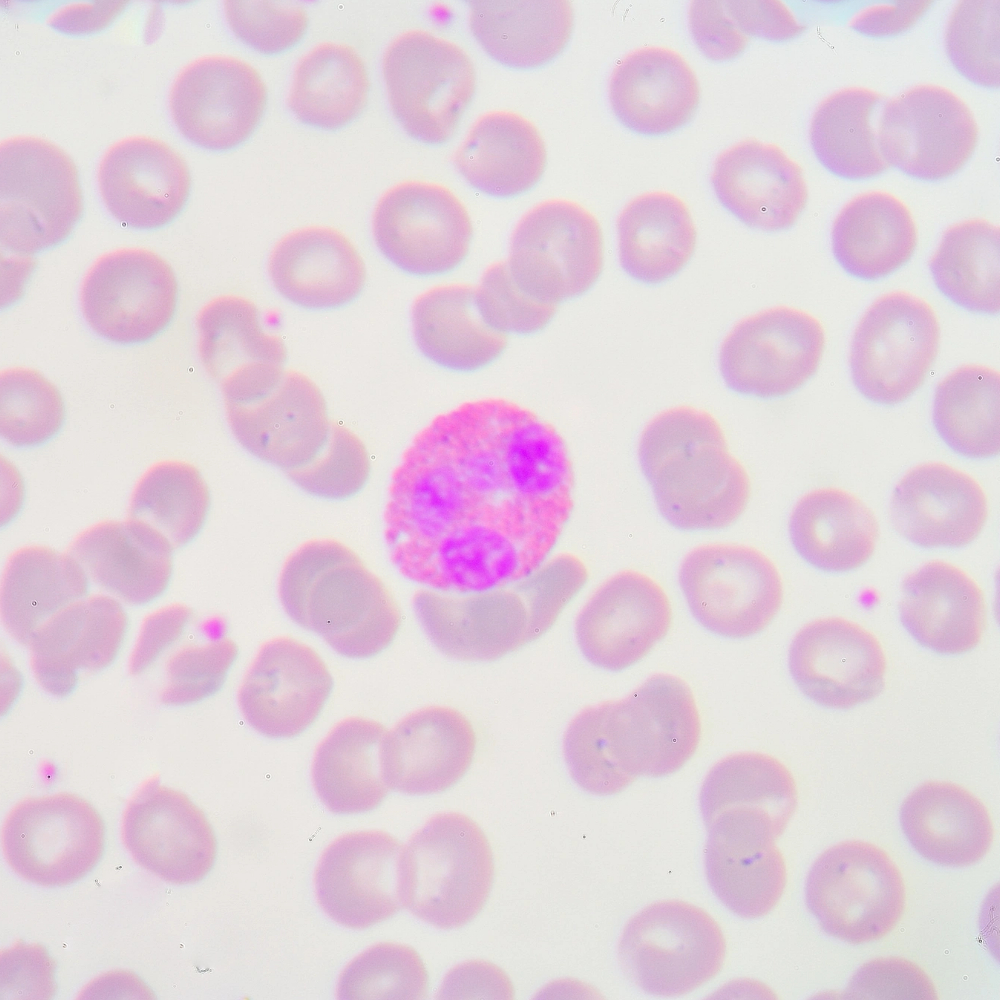 Renforcer le système immunitaire